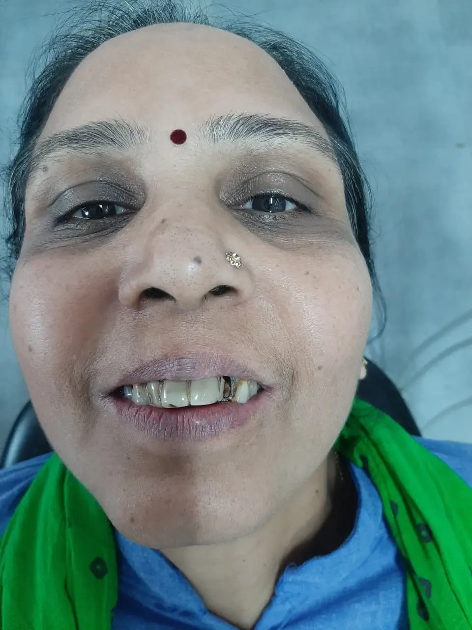 Patient portrait before dental treatment.
