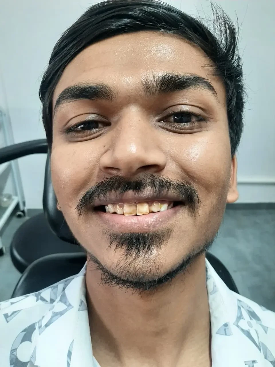 Patient portrait before dental treatment.
