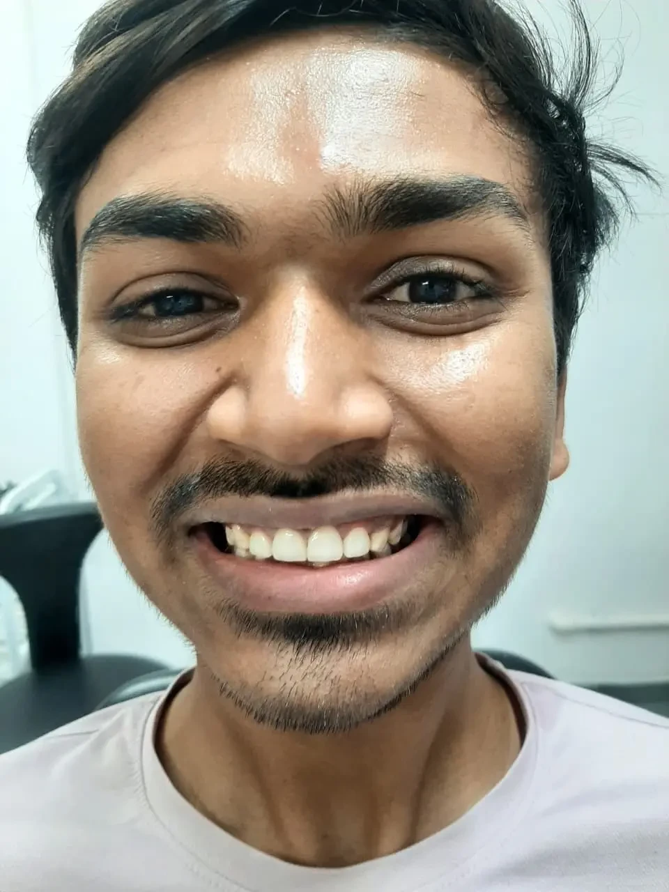 Patient portrait after dental treatment.